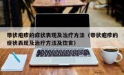 带状疱疹的症状表现及治疗方法（带状疱疹的症状表现及治疗方法及饮食）